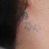 Rimuovere un tatuaggio sul collo é pericoloso? - 17176