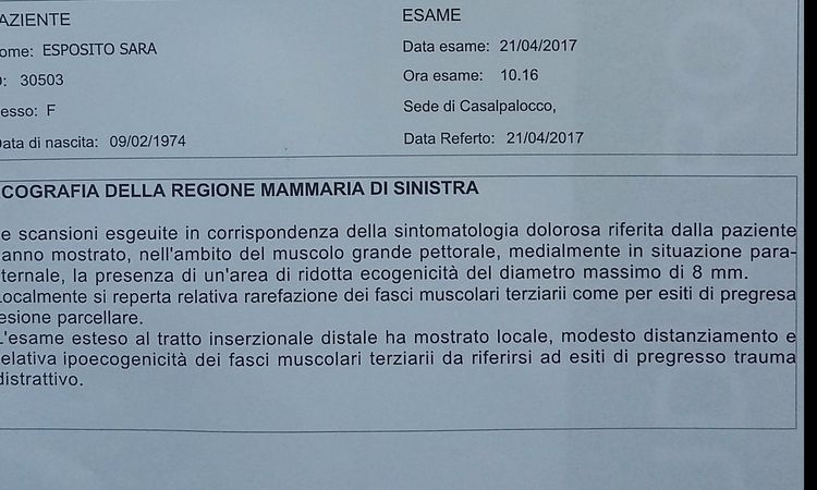 Strappo al gran pettorale dopo mastoplastica additiva - 17337