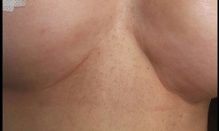 Rippling o no? - 17672