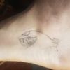 Prezzo rimozione tatuaggio.