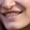 Labbra asimmetriche quando sorrido - 19102