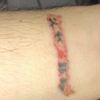 Napoli. Ho effettuato la 1 seduta per la rimozione del mio tattoo