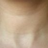 Rughe sul collo, collana di venere