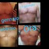 Come sta procedendo l'operazione di mastectomia