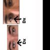 Dimensioni e Forme occhi diverse - 32417