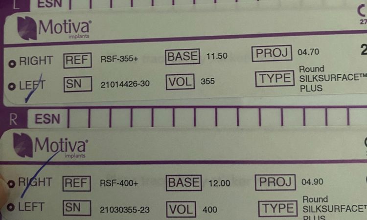 Come leggere il tesserino delle protesi motiva - 32886