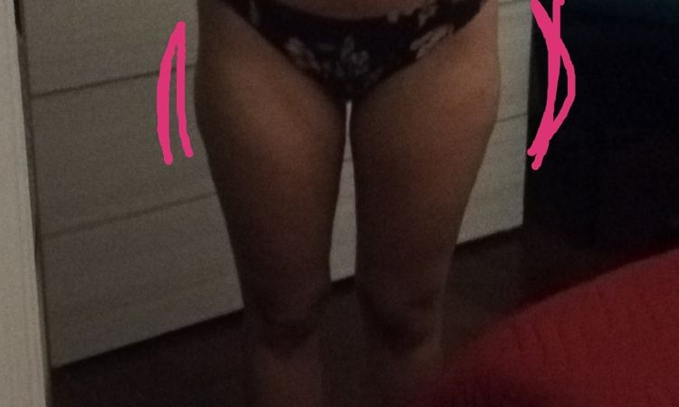 Come trattare le culotte de cheval - 33128