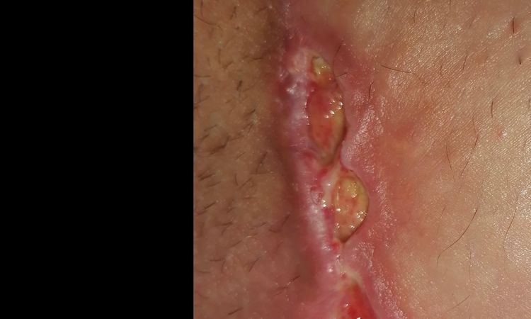 Problemi con una cicatrice - 33490