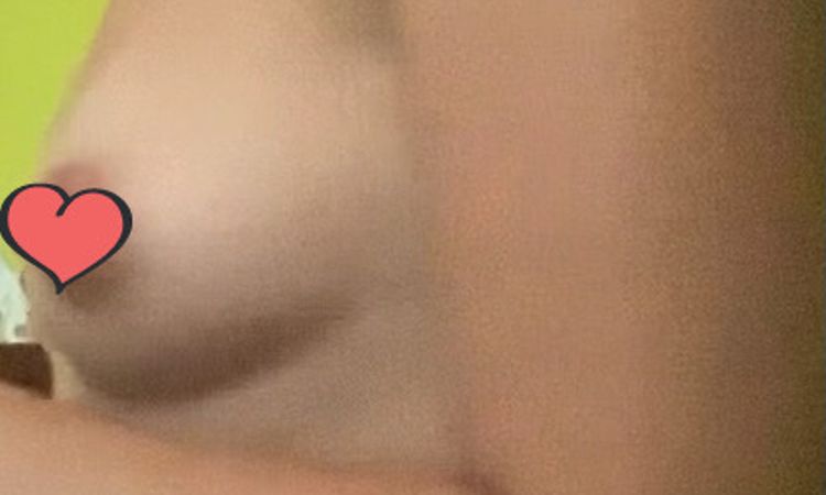 Protesi per seno distante con effetto naturale - 43810