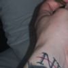 Post laser rimozione tatuaggi - 44982
