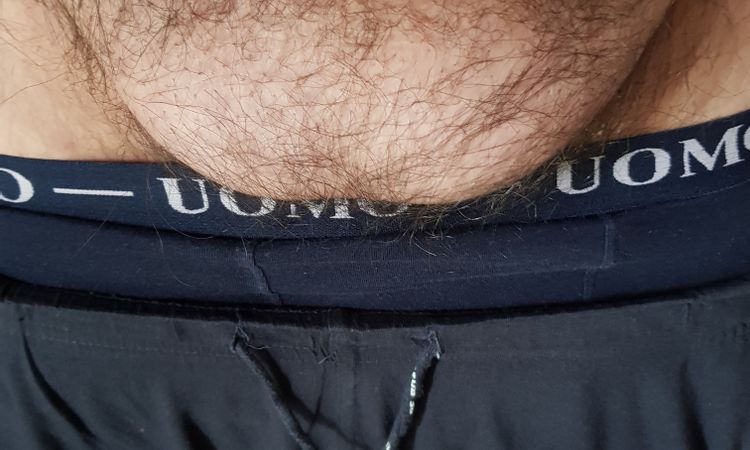 Liposuzione Pube grasso - 47421
