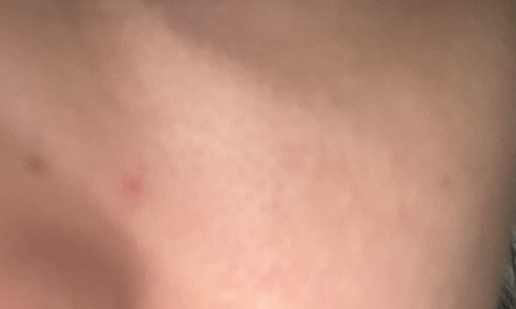 Ho occhiaie scure da 6anni - 48523