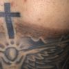 Post laser qswitched tatuaggio - 51277
