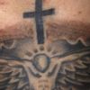 Post laser qswitched tatuaggio - 51279