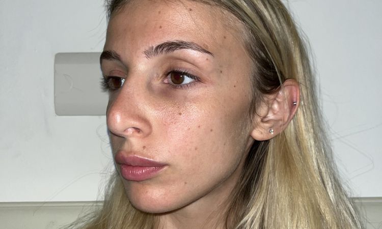 Si può sistemare il mio naso? - 52826