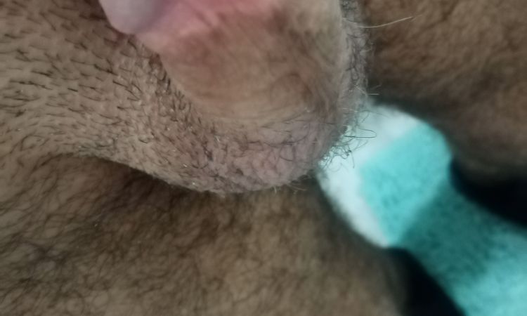 Cicatrice post frenulotomia - 52832