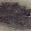 Macchia/capillare che compare e scompare sulla gamba - 53756
