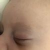 Macchia neonata di 2 mesi color marrone con puntino più scuro  sotto l'occhio