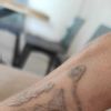 Rimozione tatuaggio disastrosa, sale e plasma? - 56741