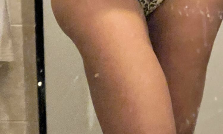 Correzione Liposcultura. - 63348