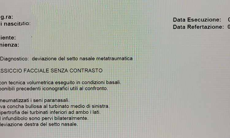 Frammenti osseo post primaria possibili soluzioni? - 64199