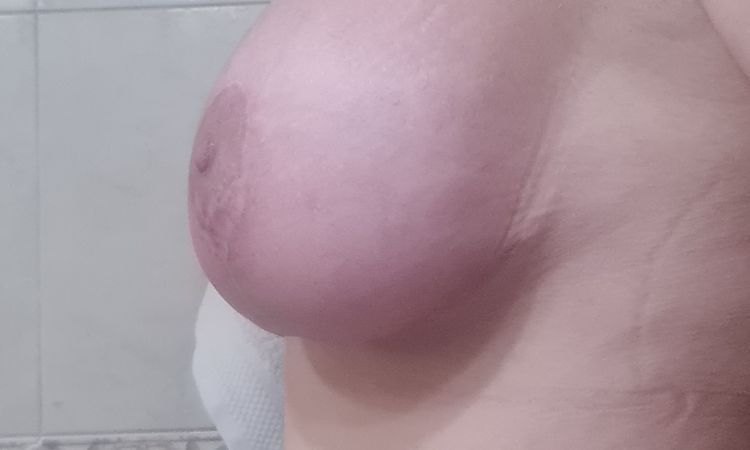 Mastopessi preoccupazione - 65746