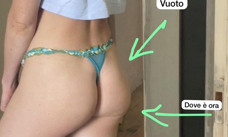 Migrazione filler glutei, aiuto! - 66167