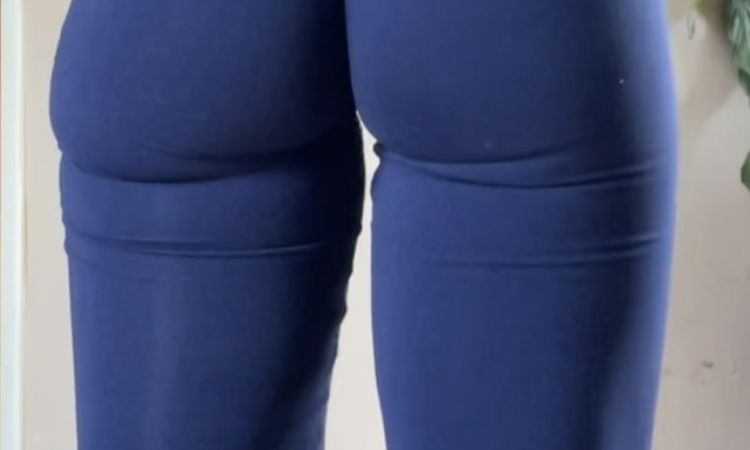 Migrazione filler glutei, aiuto! - 66168