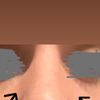 Ossa laterali rinoplastica - 66189