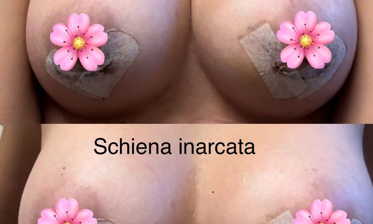 Sinmastia o gonfiore? - 69483