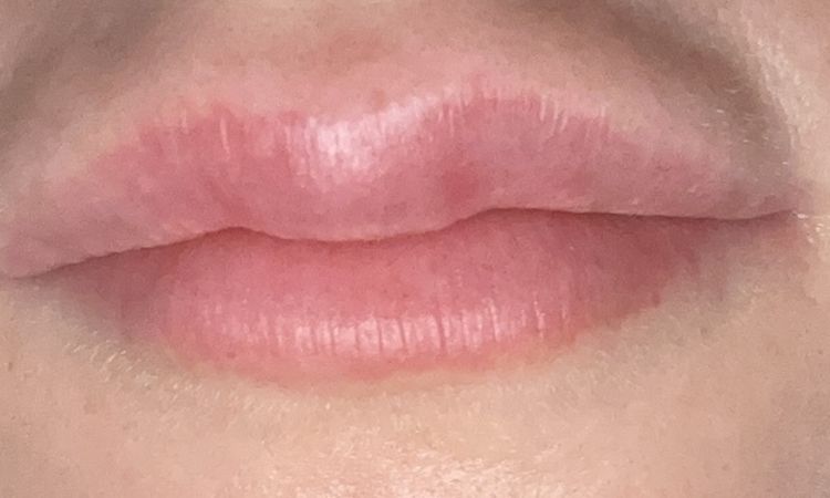 Filler labbra concentrato - 70968