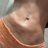Problema post liposuzione