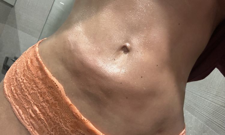 Problema post liposuzione - 72071