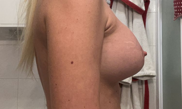 Riposizionamento protesi seno in ambulatorio? - 72137