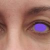 Condizioni di salute che possono pregiudicare trattamenti per zona peri-oculare