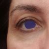 Condizioni di salute che possono pregiudicare trattamenti per zona peri-oculare