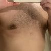 Post operatorio ginecomastia 4 mesi