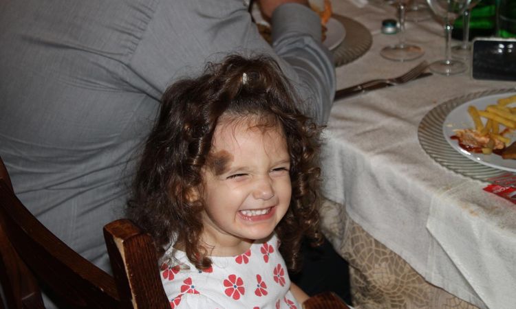 Nevo melanocitico congenito bambina di 3 anni - 79169