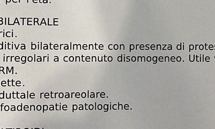 Controllo mastoplastica effettuata 12 anni fa - 79640