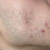 Domanda Peeling prx t-33