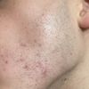 Domanda Peeling prx t-33