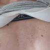 Soluzioni muscolo seno devastato
