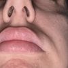 Bozzetti o Filler finito?