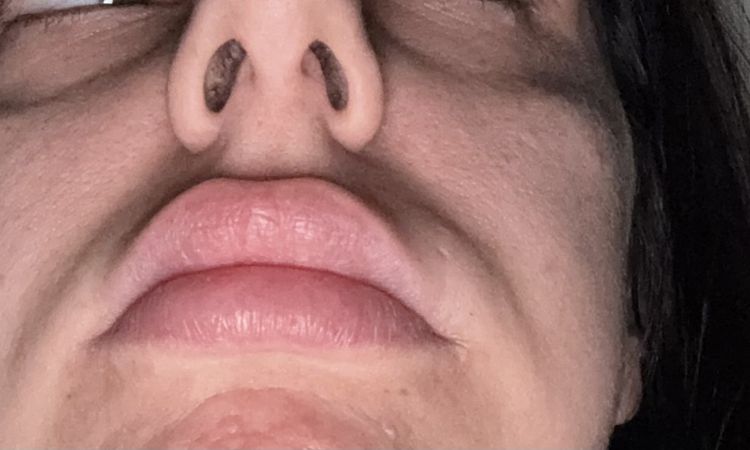 Bozzetti o Filler finito? - 80961