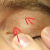 Dermatite sulla palpebra?