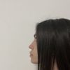 Risultato deludente due mesi post rinoplastica