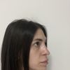 Risultato deludente due mesi post rinoplastica