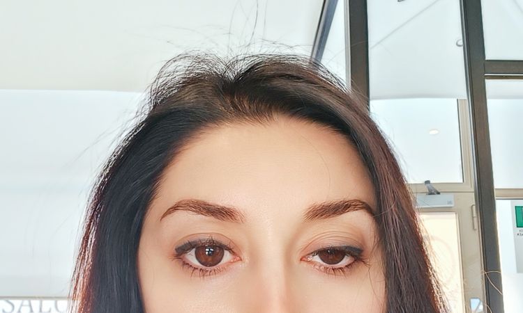 Filler guance e botox fronte - 81606