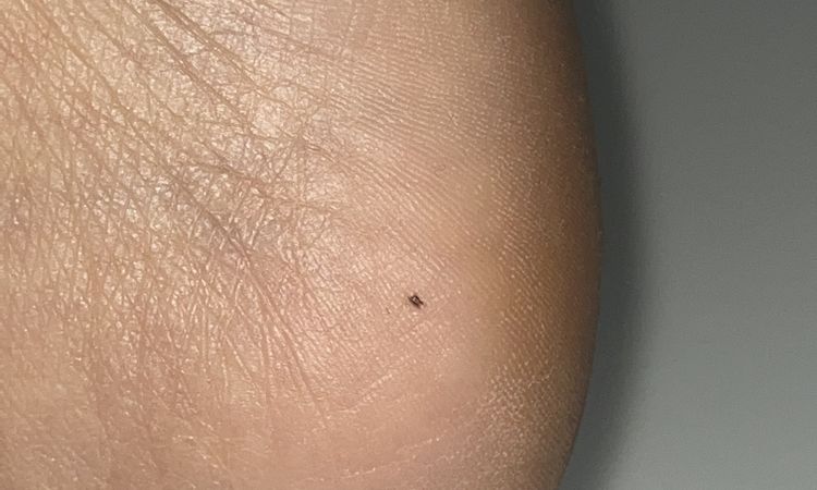 Neo sul tallone da 1 anno - 81727