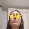 Narici completamente diverse post rinosettoplastica